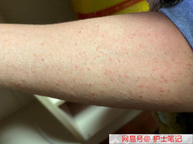 采集或者使用人体的什么进行艾滋病检测(艾滋病防治条例规定采集或使用人体应当进行艾滋病检测)